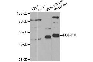 Western blot analysis of extracts of various cell lines, using KCNJ10 Antibody (ABIN6003558) at 1/1000 dilution. (KCNJ10 Antikörper)