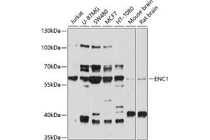Western blot analysis of extracts of various cell lines, using ENC1 antibody (ABIN6130834, ABIN6140166, ABIN6140167 and ABIN6214438) at 1:1000 dilution. (ENC1 Antikörper  (AA 1-270))