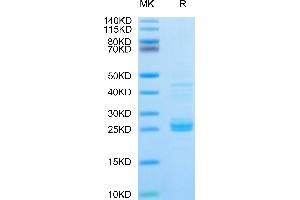 Biotinylated Mouse IL-23A on Tris-Bis PAGE under reduced condition. (IL23A Protein (AA 22-196) (His-Avi Tag,Biotin))