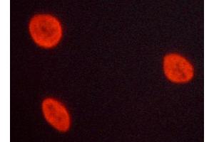 Immunofluorescence (fixed cells) (IF/ICC) image for anti-Nuclear Factor of kappa Light Polypeptide Gene Enhancer in B-Cells 1 (NFKB1) (C-Term) antibody (ABIN6263615)