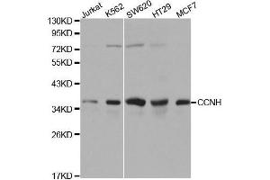 Western blot analysis of extracts of various cell lines, using CCNH antibody. (Cyclin H Antikörper  (AA 1-323))