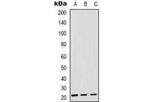 Western blot analysis of SAR1B expression in HEK293T (A), Hela (B), RAW264.