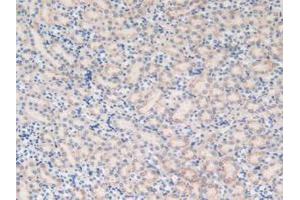 Figure. (MGST1 Antikörper  (AA 8-155))