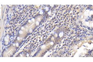 Detection of CDK2AP1 in Human Small intestine Tissue using Polyclonal Antibody to Cyclin Dependent Kinase 2 Associated Protein 1 (CDK2AP1) (CDK2AP1 Antikörper  (AA 1-115))