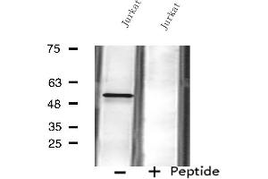 Western blot analysis of extracts from Jurkat cells using FKRP antibody. (FKRP Antikörper  (N-Term))