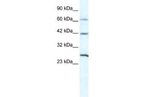 WB Suggested Anti-GJC1 Antibody Titration:  5. (GJC1 Antikörper  (N-Term))