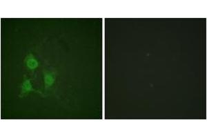 Immunofluorescence analysis of A549 cells, using PKA CAT (Phospho-Thr197) Antibody. (PKA CAT (AA 166-215), (pThr198) Antikörper)