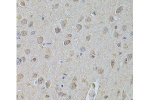 Immunohistochemistry of paraffin-embedded Mouse brain using NME1 Polyclonal Antibody at dilution of 1:200 (40x lens). (NME1 Antikörper)