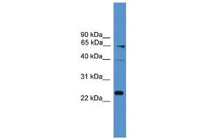 WB Suggested Anti-CD7 Antibody Titration: 0. (CD7 Antikörper  (Middle Region))