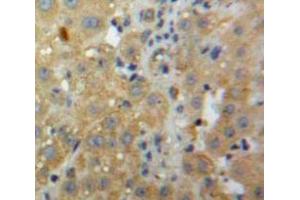 IHC-P analysis of Liver tissue, with DAB staining. (CXCL2 Antikörper  (AA 28-100))