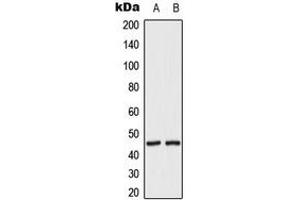 Western blot analysis of MKK2 (pT394) expression in HeLa UV-treated (A), HepG2 UV-treated (B) whole cell lysates. (MEK2 Antikörper  (C-Term, pSer394))
