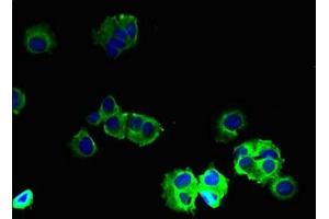 Immunofluorescence (IF) image for anti-gamma-aminobutyric Acid (GABA) A Receptor, beta 2 (GABRB2) (AA 26-244) antibody (ABIN7153493)