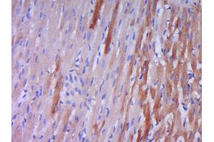 Paraformaldehyde-fixed, paraffin embedded rat heart muscle Antigen retrieval by boiling in sodium citrate buffer (pH6. (Prepro-Endothelin-1 (AA 16-110) Antikörper)