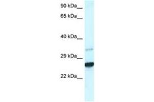 Image no. 1 for anti-Caudal Type Homeobox 1 (CDX1) (AA 195-244) antibody (ABIN6747429)