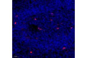 Immunofluorescence (Paraffin-embedded Sections) (IF (p)) image for anti-Caspase 3 (CASP3) (cleaved) antibody (ABIN7073336)