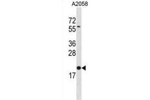 BLOC1S3 Antibody (C-term) (ABIN1881114 and ABIN2838858) western blot analysis in  cell line lysates (35 μg/lane). (BLOC1S3 Antikörper  (C-Term))