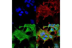 Immunocytochemistry/Immunofluorescence analysis using Mouse Anti-Notch1 Monoclonal Antibody, Clone S253-32 . (Notch1 Antikörper  (AA 20-216) (FITC))