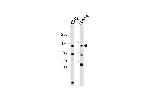 All lanes : Anti-NOP2 Antibody (N-Term) at 1:2000 dilution Lane 1: K562 whole cell lysate Lane 2: U-2OS whole cell lysate Lysates/proteins at 20 μg per lane. (Nucleolar Protein 1 (NOL1) (AA 9-43) Antikörper)