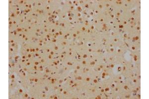 IHC image of ABIN7127538 diluted at 1:100 and staining in paraffin-embedded human brain tissue performed on a Leica BondTM system. (Rekombinanter HDAC2 Antikörper)