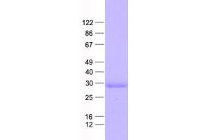 Western Blotting (WB) image for Palmitoyl-Protein Thioesterase 1 (PPT1) protein (His tag) (ABIN2729524)