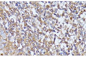 Immunohistochemistry of paraffin-embedded Human tonsil using STK24 Polyclonal Antibody at dilution of 1:100 (40x lens). (STK24 Antikörper)