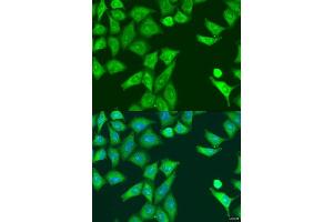 Immunofluorescence analysis of U2OS cells using EIF2AK2 antibody. (EIF2AK2 Antikörper  (AA 1-270))