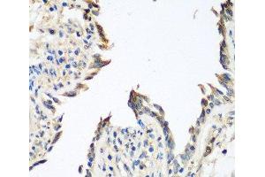 Immunohistochemistry of paraffin-embedded Human lung using GPI Polyclonal Antibody at dilution of 1:100 (40x lens). (GPI Antikörper)