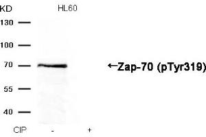 Western blot analysis of extracts from HL60 cells, treated with calf intestinal phosphatase (CIP), using Zap-70 (Phospho-Tyr319) Antibody. (ZAP7 (pTyr319) Antikörper)