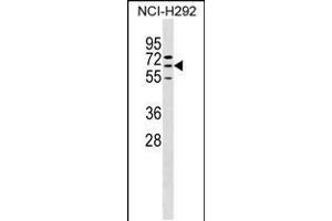 Western blot analysis in NCI-H292 cell line lysates (35ug/lane). (ZNF599 Antikörper  (N-Term))