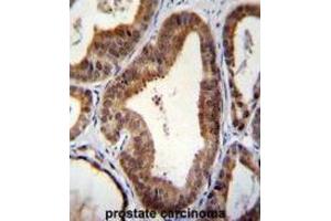 Immunohistochemistry (IHC) image for anti-SHQ1 Homolog (SHQ1) antibody (ABIN2996338) (SHQ1 Antikörper)