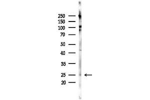 anti-Zinc and Ring Finger Protein 1 (ZNRF1) (Internal Region) antibody