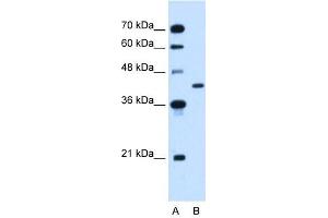 GOT2 antibody used at 2. (GOT2 Antikörper)