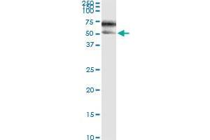 Immunoprecipitation of SERPINA3 transfected lysate using anti-SERPINA3 monoclonal antibody and Protein A Magnetic Bead , and immunoblotted with SERPINA3 MaxPab rabbit polyclonal antibody. (SERPINA3 Antikörper  (AA 25-423))