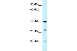 Western Blot showing GALK1 antibody used at a concentration of 1 ug/ml against Fetal Liver Lysate (GALK1 Antikörper  (C-Term))