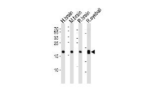 Western blot analysis of lysates from human brain, mouse brain, rat brain and rat eyeball tissue lysate (from left to right), using VILIP1 Antibody at 1:1000 at each lane. (VSNL1 Antikörper  (C-Term))