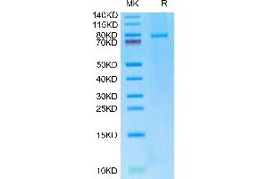 Human CD40 Ligand (Trimer) on Tris-Bis PAGE under reduced condition. (CD40 Ligand Protein (CD40LG) (Trimer) (Fc Tag))