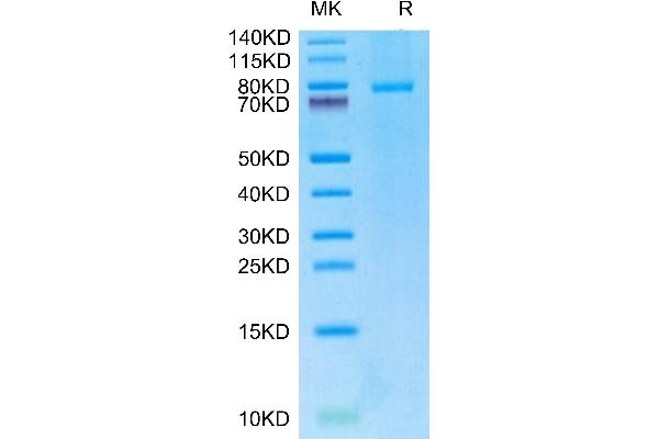 CD40 Ligand Protein (CD40LG) (Trimer) (Fc Tag)