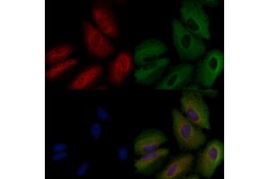 ABIN6258783 and ABIN6274160 staining  cells by IF/ICC. (Fgr Antikörper  (Internal Region))