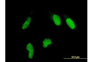 Immunofluorescence of monoclonal antibody to GLTSCR2 on HeLa cell. (GLTSCR2 Antikörper  (AA 402-478))