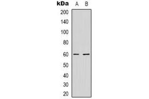 Western blot analysis of NXF3 expression in HepG2 (A), MCF7 (B) whole cell lysates. (NXF3 Antikörper)