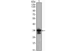 Western blot analysis using CDC2 mouse mAb against Jurkat (1) cell lysate. (CDK1 Antikörper)