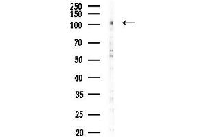 Western blot analysis of lysates from HUVEC cells(LPS 4h treatment), using Phospho-FAK (Tyr861) Antibody at 1/1000 dilution.