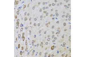 Immunohistochemistry of paraffin-embedded rat brain using BTD antibody (ABIN5973709) at dilution of 1/100 (40x lens). (BTD Antikörper)