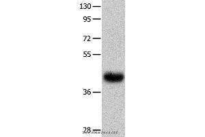 Western blot analysis of Human fetal muscle tissue  , using UTS2R Polyclonal Antibody at dilution of 1:400 (UTS2R Antikörper)