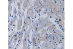Used in DAB staining on fromalin fixed paraffin- embedded heart tissue (TOP3B Antikörper  (AA 1-250))