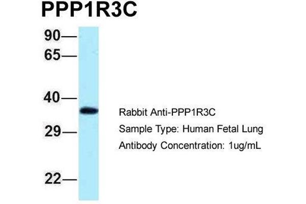 PPP1R3C antibody  (N-Term)
