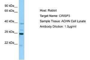 Western Blotting (WB) image for anti-Cysteine-Rich Secretory Protein 3 (CRISP3) (N-Term) antibody (ABIN2789796) (CRISP3 Antikörper  (N-Term))