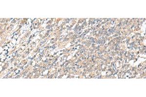 Immunohistochemistry of paraffin-embedded Human tonsil tissue using WDR47 Polyclonal Antibody at dilution of 1:35(x200)