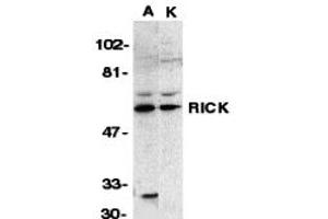 Western Blotting (WB) image for anti-Receptor-Interacting Serine-threonine Kinase 2 (RIPK2) (N-Term) antibody (ABIN1031540) (RIPK2 Antikörper  (N-Term))