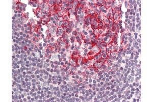 Anti-BIRC8 / ILP2 antibody IHC of human small intestine, Peyer's patch.